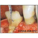 Freza chirurgicala C254A - imagine 3