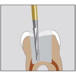 Freza extradura endo C269GKS - imagine 3