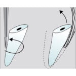 Freza chirurgicala C560 - imagine 4