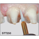 Freza gingivectomie STT250 - imagine 3